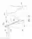 Fig. 20 - Method and apparatus for performing anterior hip surgery