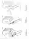 Fig. 07 - Method and apparatus for post-operative tuning of a spinal implant