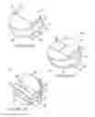 Fig. 19 - Method and apparatus for post-operative tuning of a spinal implant