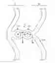 Fig. 01 - SCAFFOLDS HAVING RADIOPAQUE MARKERS