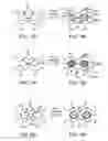 Fig. 06 - SCAFFOLDS HAVING RADIOPAQUE MARKERS