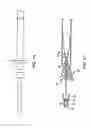 Fig. 35 - Methods and apparatus for luminal stenting