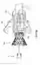 Fig. 16 - System for loading a transcatheter valve prosthesis into a delivery catheter