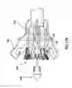 Fig. 17 - System for loading a transcatheter valve prosthesis into a delivery catheter