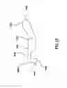 Fig. 24 - System for loading a transcatheter valve prosthesis into a delivery catheter