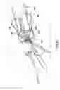 Fig. 27 - System for loading a transcatheter valve prosthesis into a delivery catheter