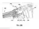 Fig. 29 - System for loading a transcatheter valve prosthesis into a delivery catheter