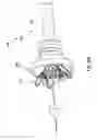 Fig. 34 - System for loading a transcatheter valve prosthesis into a delivery catheter