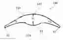 Fig. 01 - REMOVABLE ORAL DEVICES FOR USE IN WEIGHT MANAGEMENT AND OTHER APPLICATIONS