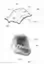 Fig. 03 - REMOVABLE ORAL DEVICES FOR USE IN WEIGHT MANAGEMENT AND OTHER APPLICATIONS
