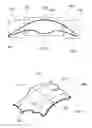 Fig. 03 - METHODS OF USING REMOVABLE ORAL DEVICES