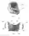 Fig. 04 - METHODS OF USING REMOVABLE ORAL DEVICES