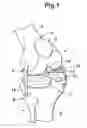Fig. 02 - JOINT MECHANISM