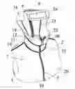 Fig. 01 - EXTERNAL FIXATION DEVICE FOR CERVICAL VERTEBRA