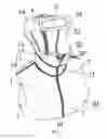 Fig. 02 - EXTERNAL FIXATION DEVICE FOR CERVICAL VERTEBRA