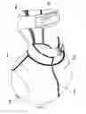 Fig. 03 - EXTERNAL FIXATION DEVICE FOR CERVICAL VERTEBRA