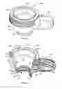 Fig. 06 - Liquid optical interface for laser eye surgery system