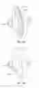 Fig. 08 - Liquid optical interface for laser eye surgery system