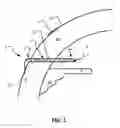 Fig. 02 - Eye treatment devices and methods