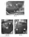 Fig. 19 - Eye treatment devices and methods