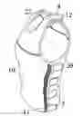 Fig. 01 - EXTERNAL FIXATION DEVICE FOR BODY