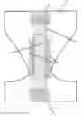 Fig. 01 - DISPOSABLE ABSORBENT ARTICLE INCLUDING A LEAK BARRIER