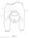 Fig. 07 - ORTHOPEDIC POST PAD
