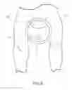 Fig. 08 - ORTHOPEDIC POST PAD