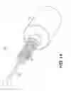 Fig. 25 - Methods, compositions, and devices for supplying dietary fatty acid needs