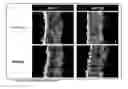 Fig. 06 - METHOD AND COMPOSITION FOR A SACHA INCHI PERENNIAL PLANT EXTRACT BASED HEALTH AND BEAUTY AID
