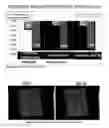 Fig. 09 - METHOD AND COMPOSITION FOR A SACHA INCHI PERENNIAL PLANT EXTRACT BASED HEALTH AND BEAUTY AID