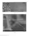 Fig. 03 - Methods and biocompatible compositions to achieve sustained drug release in the eye