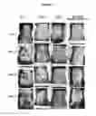 Fig. 02 - INHIBITORS OF PLASMINOGEN FOR TREATING, REDUCING OR PREVENTING RADIATION-INDUCED INJURIES