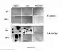 Fig. 46 - Retinoid compositions and methods of increasing immune cell-mediated killing of IDH mutant cancer cells