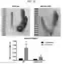 Fig. 10 - COMPOSITIONS AND METHODS FOR INHIBITING AUTOPHAGY AND CONTRACEPTION