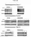 Fig. 13 - COMPOSITIONS AND METHODS FOR INHIBITING AUTOPHAGY AND CONTRACEPTION
