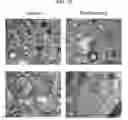 Fig. 14 - COMPOSITIONS AND METHODS FOR INHIBITING AUTOPHAGY AND CONTRACEPTION