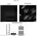 Fig. 15 - COMPOSITIONS AND METHODS FOR INHIBITING AUTOPHAGY AND CONTRACEPTION