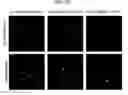 Fig. 24 - COMPOSITIONS AND METHODS FOR INHIBITING AUTOPHAGY AND CONTRACEPTION