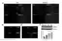 Fig. 01 - Methods for pharmacologic treatment of stroke