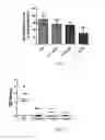 Fig. 12 - Methods for pharmacologic treatment of stroke