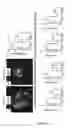 Fig. 04 - METHODS AND PHARMACEUTICAL COMPOSITIONS FOR THE TREATMENT OF CHOROIDAL NEOVASCULARISATION