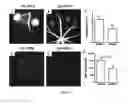 Fig. 07 - METHODS AND PHARMACEUTICAL COMPOSITIONS FOR THE TREATMENT OF CHOROIDAL NEOVASCULARISATION