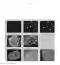 Fig. 09 - Agent for Treating Urinary Incontinence Including Stem Cells Derived from Amniotic Fluid