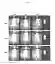 Fig. 20 - Agent for Treating Urinary Incontinence Including Stem Cells Derived from Amniotic Fluid