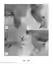 Fig. 22 - Phosphorylcholine conjugates and uses thereof