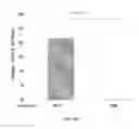 Fig. 32 - Phosphorylcholine conjugates and uses thereof
