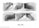 Fig. 35 - Phosphorylcholine conjugates and uses thereof