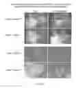 Fig. 22 - Compositions and methods for modulating toll-like receptor 2 activation