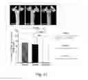 Fig. 25 - Modulation of proprotein convertase subtilisin/kexin 9 expression (PCSK9) with HSP 27 and/or HSP25